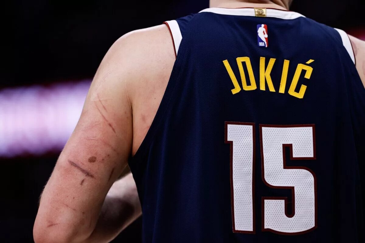 A detail view of the scars on the left arm of Denver Nuggets center Nikola Jokic (15) in the third quarter against the Los Angeles Lakers at Ball Arena.